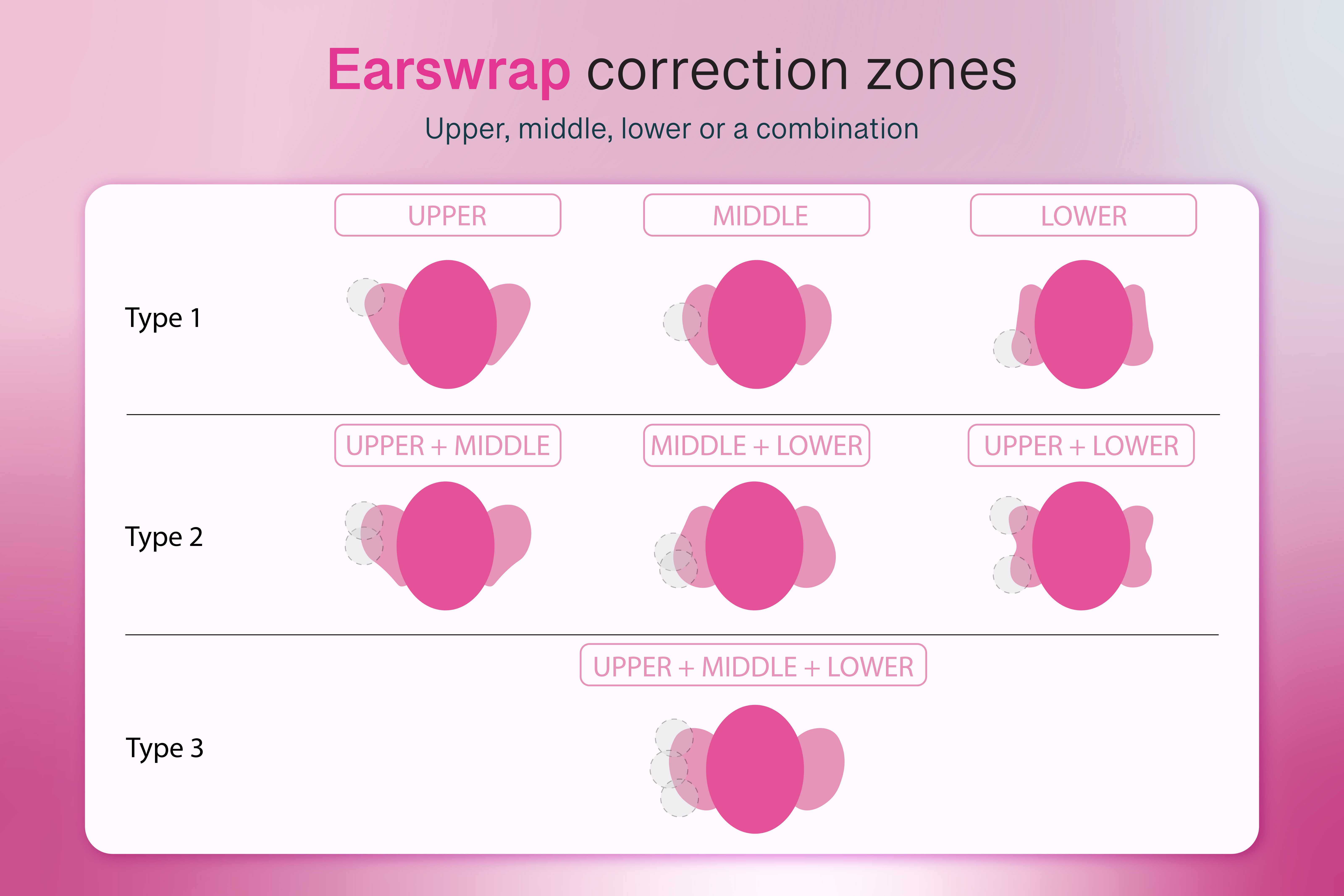 Earswrap correction zones explained: upper, middle, lower and combination