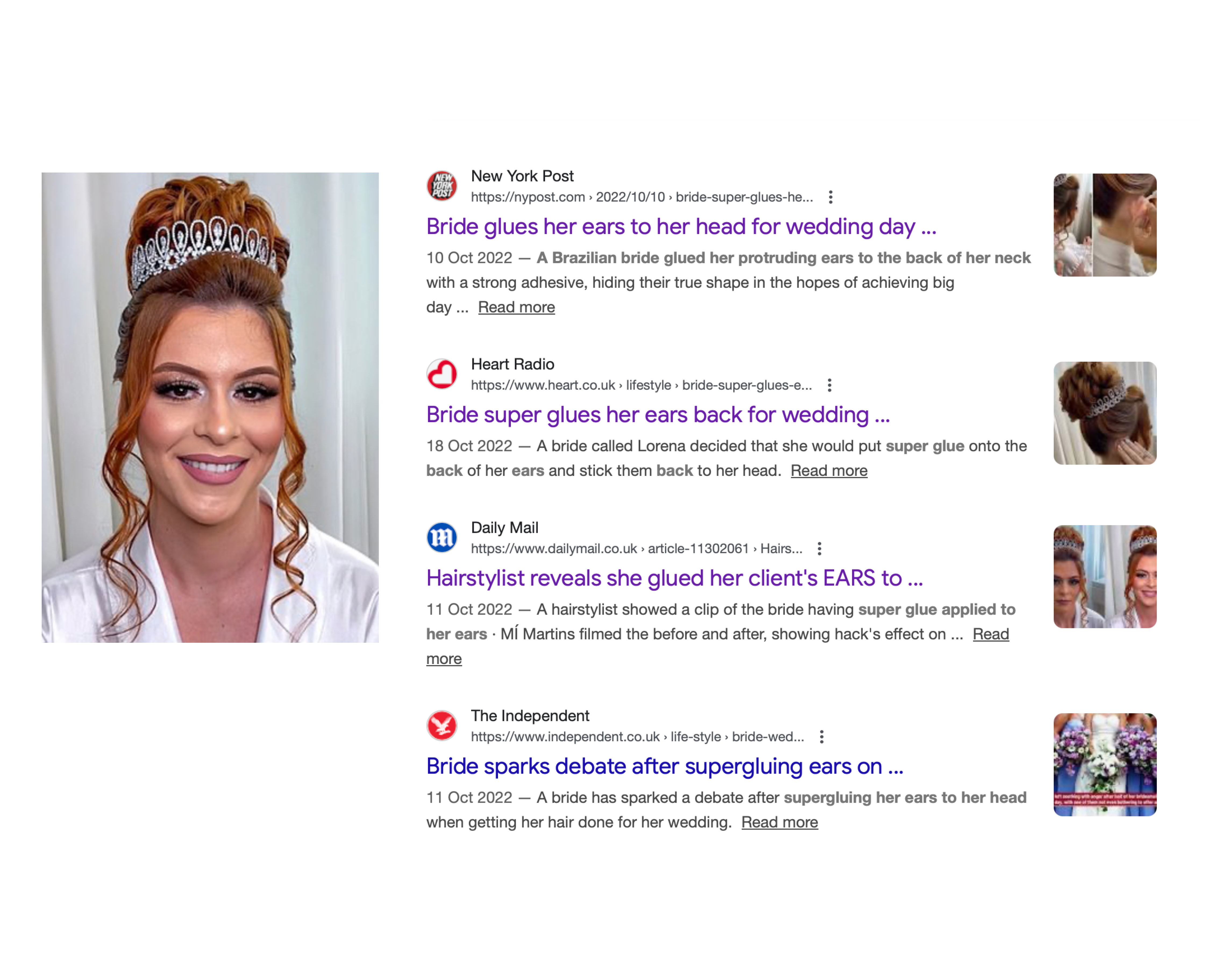 Bride superglued her ears for her wedding day: why this should never be necessary again